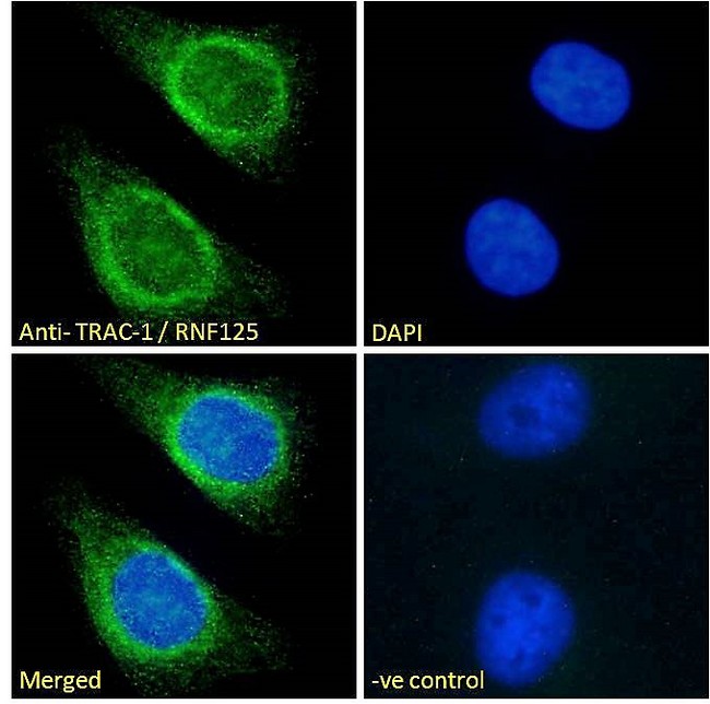 RNF125 / TRAC-1 Antibody - Goat Anti-TRAC-1 / RNF125 Antibody Immunofluorescence analysis of paraformaldehyde fixed HeLa cells, permeabilized with 0.15% Triton. Primary incubation 1hr (10ug/ml) followed by Alexa Fluor 488 secondary antibody (2ug/ml), showing endoplasmic reticulum/Golgi and some nuclear staining. The nuclear stain is DAPI (blue). Negative control: Unimmunized goat IgG (10ug/ml) followed by Alexa Fluor 488 secondary antibody (2ug/ml).