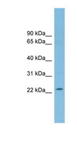 RNF125 / TRAC-1 Antibody - RNF125 antibody Western blot of THP-1 cell lysate. This image was taken for the unconjugated form of this product. Other forms have not been tested.