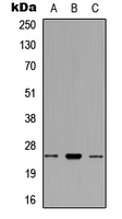 RNF125 / TRAC-1 Antibody - Western blot analysis of RNF125 expression in HEK293T (A); THP1 (B); 129Sv (C) whole cell lysates.