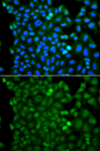 RNF125 / TRAC-1 Antibody - Immunofluorescence analysis of A549 cells.