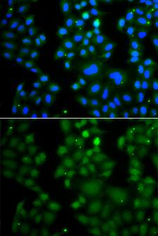 RNF125 / TRAC-1 Antibody - Immunofluorescence analysis of A549 cells.