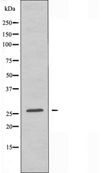 RNF125 / TRAC-1 Antibody - Western blot analysis of extracts of K562 cells using RNF125 antibody.