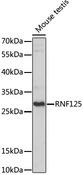 RNF125 / TRAC-1 Antibody - Western blot analysis of extracts of Mouse testis using RNF125 Polyclonal Antibody at dilution of 1:1000.