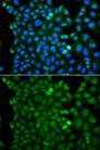 RNF125 / TRAC-1 Antibody - Immunofluorescence analysis of A549 cells using RNF125 Polyclonal Antibody.