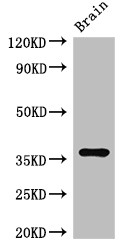 RNF126 Antibody - Positive WB detected in:Mouse brain tissue;All lanes:RNF126 antibody at 2.7?g/ml;Secondary;Goat polyclonal to rabbit IgG at 1/50000 dilution;Predicted band size: 36,34 KDa;Observed band size: 36 KDa;