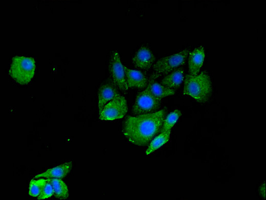 RNF126 Antibody - Immunofluorescent analysis of HepG2 cells using RNF126 Antibody at a dilution of 1:100 and Alexa Fluor 488-congugated AffiniPure Goat Anti-Rabbit IgG(H+L)