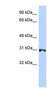 RNF126 Antibody - RNF126 antibody Western blot of Jurkat lysate. This image was taken for the unconjugated form of this product. Other forms have not been tested.