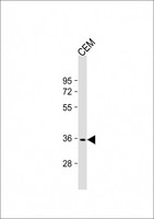 RNF126 Antibody - Anti-RNF126 Antibody (Center) at 1:2000 dilution + CEM whole cell lysate Lysates/proteins at 20 ug per lane. Secondary Goat Anti-Rabbit IgG, (H+L), Peroxidase conjugated at 1:10000 dilution. Predicted band size: 36 kDa. Blocking/Dilution buffer: 5% NFDM/TBST.