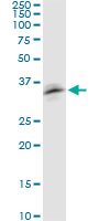 RNF126 Antibody - RNF126 monoclonal antibody (M04), clone 3F11. Western blot of RNF126 expression in NIH/3T3.