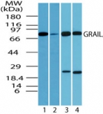 RNF128 / GRAIL Antibody - Western blot of human GRAIL in human spleen lysate in the 1) absence and2) presence of immunizing peptide, 3) mouse spleen and 4) rat spleen using antibody at1 ug/ml.