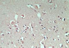 RNF128 / GRAIL Antibody - IHC of normal human brain using antibody (GRAIL) at 5 ug/ml.