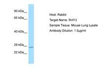 RNF13 Antibody -  This image was taken for the unconjugated form of this product. Other forms have not been tested.
