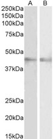 RNF13 Antibody - RNF13 antibody (2 ug/ml) staining of Mouse (A) and Rat (B) Eye lysates (35 ug protein in RIPA buffer). Primary incubation was 1 hour. Detected by chemiluminescence