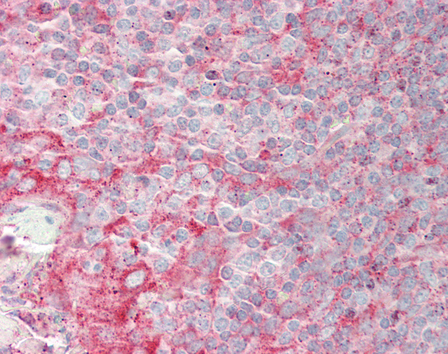 RNF13 Antibody - Human Tonsil: Formalin-Fixed, Paraffin-Embedded (FFPE).  This image was taken for the unconjugated form of this product. Other forms have not been tested.