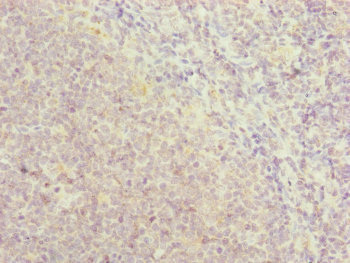RNF13 Antibody - Immunohistochemistry of paraffin-embedded human tonsil tissue at dilution of 1:100