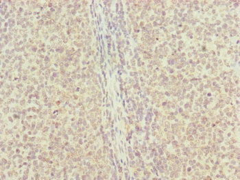 RNF13 Antibody - Immunohistochemistry of paraffin-embedded human tonsil tissue at dilution of 1:100