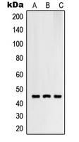 RNF130 Antibody - Western blot analysis of RNF130 expression in SKMEL28 (A); HUVEC (B); HeLa (C) whole cell lysates.