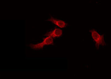 RNF130 Antibody - Staining HeLa cells by IF/ICC. The samples were fixed with PFA and permeabilized in 0.1% Triton X-100, then blocked in 10% serum for 45 min at 25°C. The primary antibody was diluted at 1:200 and incubated with the sample for 1 hour at 37°C. An Alexa Fluor 594 conjugated goat anti-rabbit IgG (H+L) Ab, diluted at 1/600, was used as the secondary antibody.