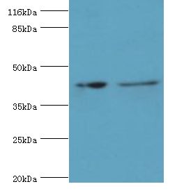 RNF133 Antibody - Western blot. All lanes: RNF133 antibody at 2 ug/ml Lane 1:K562 whole cell lysate. Lane 2: HepG2 whole cell lysate. Secondary antibody: Goat polyclonal to rabbit at 1:10000 dilution. Predicted band size: 42 kDa. Observed band size: 42 kDa.  This image was taken for the unconjugated form of this product. Other forms have not been tested.