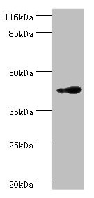 RNF133 Antibody - Western blot All lanes: RNF133 antibody at 2µg/ml + K562 whole cell lysate Secondary Goat polyclonal to rabbit IgG at 1/10000 dilution Predicted band size: 43 kDa Observed band size: 43 kDa