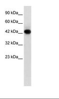 RNF135 Antibody - Jurkat Cell Lysate.  This image was taken for the unconjugated form of this product. Other forms have not been tested.