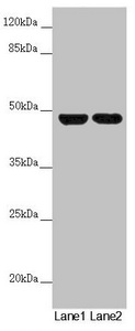 RNF135 Antibody - Western blot All Lanes:RNF135 antibody at 5.88 ug/ml Lane 1: 293T whole cell lysate Lane 2: Jurkat whole cell lysate Secondary Goat polyclonal to rabbit IgG at 1/10000 dilution Predicted band size: 48,23,31 kDa Observed band size: 48 kDa