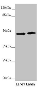 RNF135 Antibody - Western blot All Lanes:RNF135 antibody at 3.51 ug/ml Lane 1: 293T whole cell lysate Lane 2: Jurkat whole cell lysate Secondary Goat polyclonal to rabbit IgG at 1/10000 dilution Predicted band size: 48,23,31 kDa Observed band size: 48 kDa
