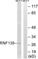 RNF138 Antibody - Western blot analysis of lysates from MCF-7 cells, using RNF138 Antibody. The lane on the right is blocked with the synthesized peptide.