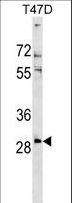RNF138 Antibody - RNF138 Antibody western blot of T47D cell line lysates (35 ug/lane). The RNF138 antibody detected the RNF138 protein (arrow).