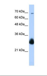 RNF138 Antibody - Transfected 293T cell lysate. Antibody concentration: 0.25 ug/ml. Gel concentration: 12%.  This image was taken for the unconjugated form of this product. Other forms have not been tested.