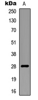 RNF138 Antibody - Western blot analysis of RNF138 expression in mouse multiple (A) whole cell lysates.