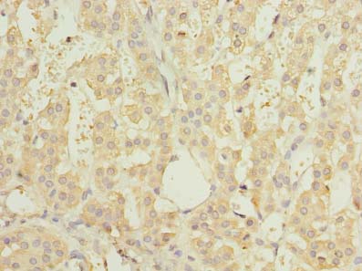 RNF138 Antibody - Immunohistochemistry of paraffin-embedded human adrenal gland tissue using antibody at dilution of 1:100.