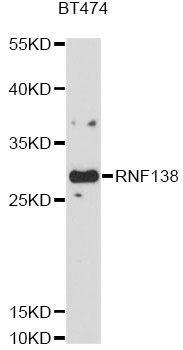 RNF138 Antibody - Western blot analysis of extracts of BT-474 cells, using RNF138 antibody at 1:1000 dilution. The secondary antibody used was an HRP Goat Anti-Rabbit IgG (H+L) at 1:10000 dilution. Lysates were loaded 25ug per lane and 3% nonfat dry milk in TBST was used for blocking. An ECL Kit was used for detection and the exposure time was 90s.