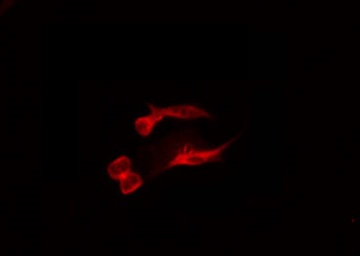 RNF138 Antibody - Staining MCF-7 cells by IF/ICC. The samples were fixed with PFA and permeabilized in 0.1% Triton X-100, then blocked in 10% serum for 45 min at 25°C. The primary antibody was diluted at 1:200 and incubated with the sample for 1 hour at 37°C. An Alexa Fluor 594 conjugated goat anti-rabbit IgG (H+L) Ab, diluted at 1/600, was used as the secondary antibody.