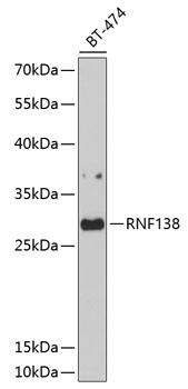 RNF138 Antibody - Western blot analysis of extracts of BT-474 cells using RNF138 Polyclonal Antibody at dilution of 1:1000.