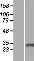 RNF138 Protein - Western validation with an anti-DDK antibody * L: Control HEK293 lysate R: Over-expression lysate