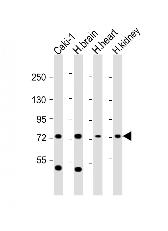 RNF139 / TRC8 Antibody - All lanes: Anti-RNF139 Antibody (C-Term) at 1:2000 dilution. Lane 1: Caki-1 whole cell lysate. Lane 2: human brain lysate. Lane 3: human heart lysate. Lane 4: human kidney lysate Lysates/proteins at 20 ug per lane. Secondary Goat Anti-Rabbit IgG, (H+L), Peroxidase conjugated at 1:10000 dilution. Predicted band size: 76 kDa. Blocking/Dilution buffer: 5% NFDM/TBST.