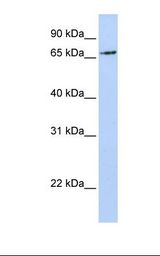 RNF139 / TRC8 Antibody - MCF7 cell lysate. Antibody concentration: 1.0 ug/ml. Gel concentration: 12%.  This image was taken for the unconjugated form of this product. Other forms have not been tested.