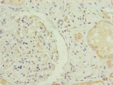 RNF139 / TRC8 Antibody - Immunohistochemistry of paraffin-embedded human kidney tissue at dilution of 1:100