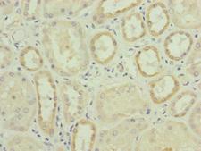 RNF139 / TRC8 Antibody - Immunohistochemistry of paraffin-embedded human kidney tissue at dilution of 1:100