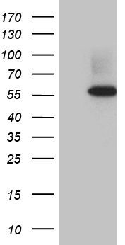 RNF14 / ARA54 Antibody - HEK293T cells were transfected with the pCMV6-ENTRY control. (Left lane) or pCMV6-ENTRY RNF14. (Right lane) cDNA for 48 hrs and lysed. Equivalent amounts of cell lysates. (5 ug per lane) were separated by SDS-PAGE and immunoblotted with anti-RNF14. (1:2000)