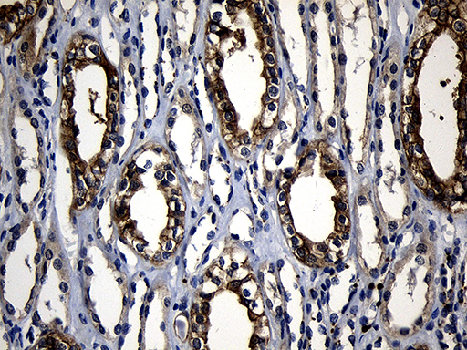 RNF14 / ARA54 Antibody - Immunohistochemical staining of paraffin-embedded Human Kidney tissue within the normal limits using anti-RNF14 mouse monoclonal antibody. (Heat-induced epitope retrieval by 1mM EDTA in 10mM Tris buffer. (pH8.5) at 120°C for 3 min. (1:500)