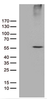 RNF14 / ARA54 Antibody - HEK293T cells were transfected with the pCMV6-ENTRY control. (Left lane) or pCMV6-ENTRY RNF14. (Right lane) cDNA for 48 hrs and lysed