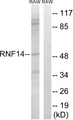 RNF14 / ARA54 Antibody - Western blot analysis of lysates from RAW264.7 cells, using RNF14 Antibody. The lane on the right is blocked with the synthesized peptide.