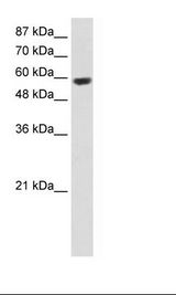 RNF14 / ARA54 Antibody - Jurkat Cell Lysate.  This image was taken for the unconjugated form of this product. Other forms have not been tested.