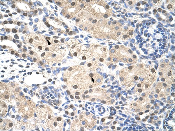 RNF14 / ARA54 Antibody - RNF14 antibody ARP38448_T100-NP_899648-RNF14 (ring finger protein 14) Antibody was used in IHC to stain formalin-fixed, paraffin-embedded human kidney.  This image was taken for the unconjugated form of this product. Other forms have not been tested.