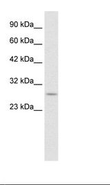 RNF141 Antibody - HepG2 Cell Lysate.  This image was taken for the unconjugated form of this product. Other forms have not been tested.