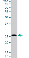 RNF141 Antibody - RNF141 monoclonal antibody (M01), clone 6D9. Western blot of RNF141 expression in PC-12.