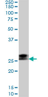 RNF141 Antibody - RNF141 monoclonal antibody (M01), clone 6D9. Western blot of RNF141 expression in Raw 264.7.