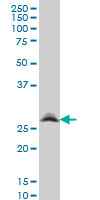 RNF141 Antibody - RNF141 monoclonal antibody (M01), clone 6D9 Western blot of RNF141 expression in A-431.